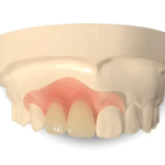 Partial Denture Front Teeth