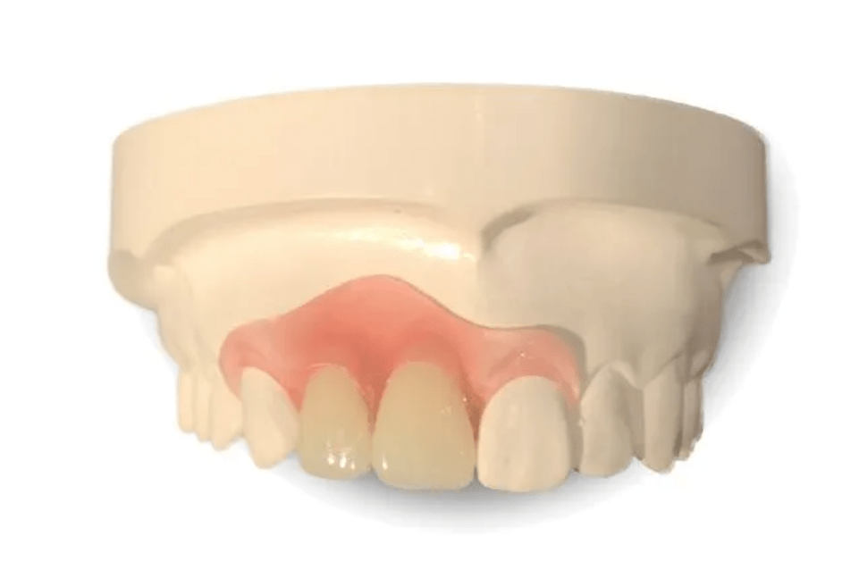 Partial Denture Front Teeth