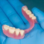 Partial Dentures