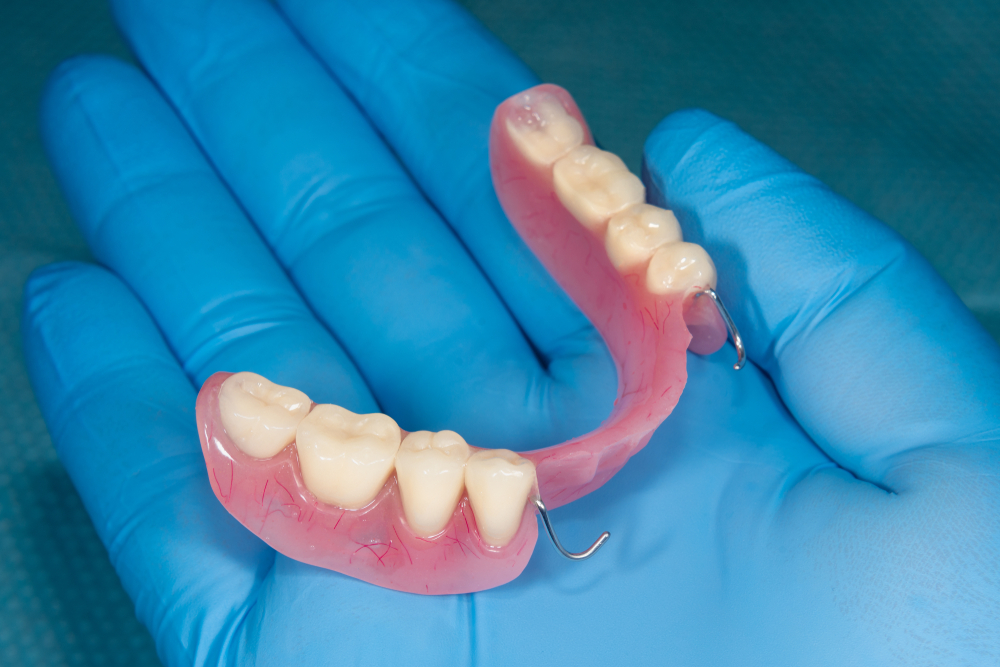 Partial Dentures