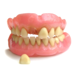 one tooth denture