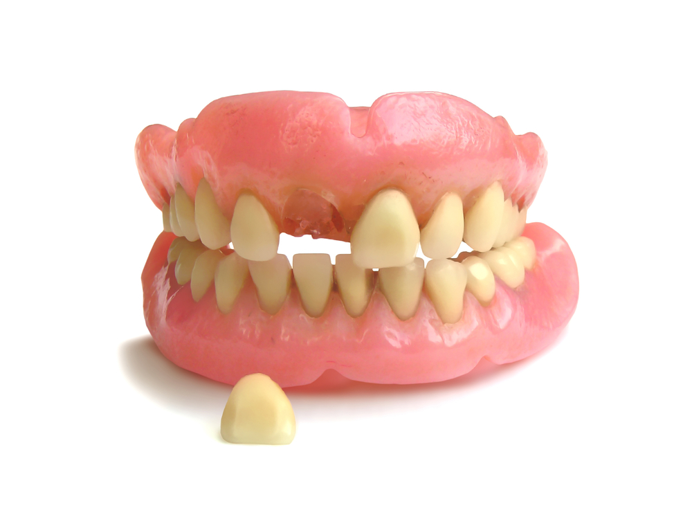 one tooth denture