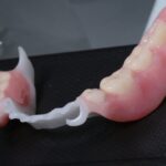 How to make a partial denture