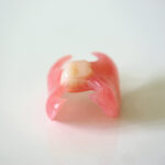 partial denture for one tooth